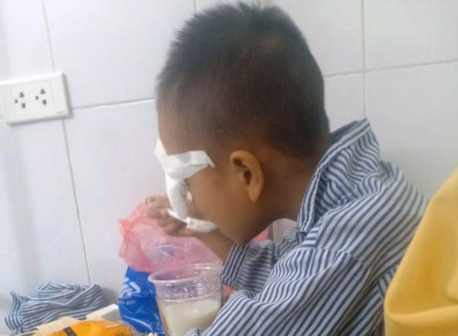 Nam sinh lớp 1 bất ngờ bị tổn thương nặng ở mắt đang được điều trị tại bệnh viện