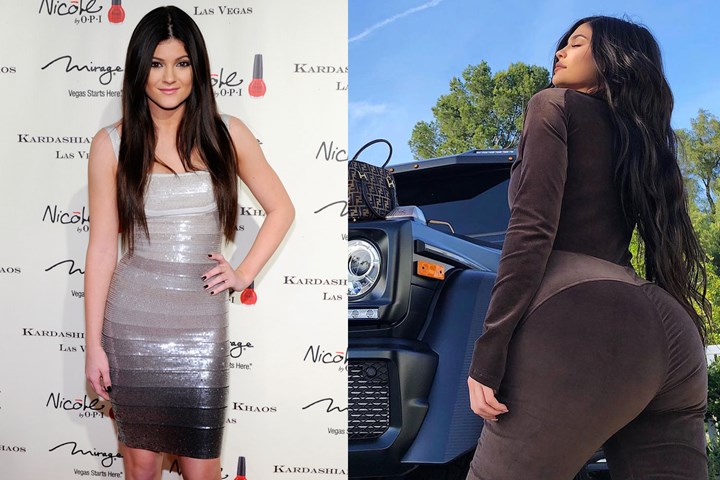 Trước đây, body của Kylie Jenner không "phồn thực" như thời điểm hiện tại.