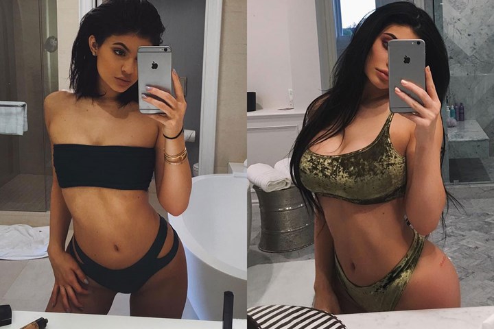 Sự thay đổi vòng một của Kylie Jenner khiến không ít người đồn cô phẫu thuật thẩm mỹ.