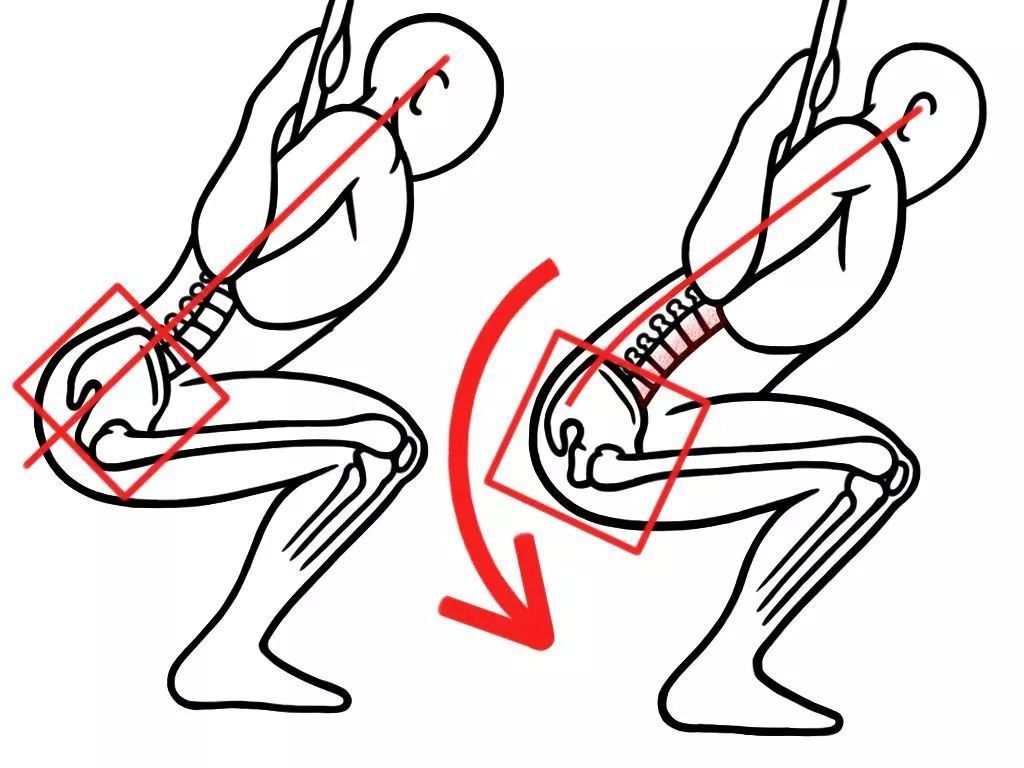 Hiện tượng "cụp mông" dễ xảy ra khi tập squats, ảnh hưởng xấu tới sức khỏe.