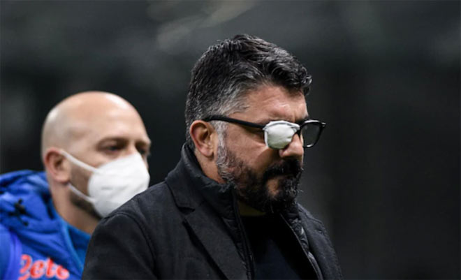 HLV Gattuso bị thương ở mắt phải tỏ ra cay cú với trọng tài chính ở trận Napoli thua đau Inter Milan