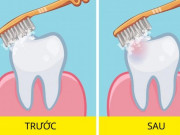 Sức khỏe đời sống - Nên đánh răng trước hay sau ăn sáng? Câu hỏi &quot;muôn thuở&quot; được chuyên gia giải đáp