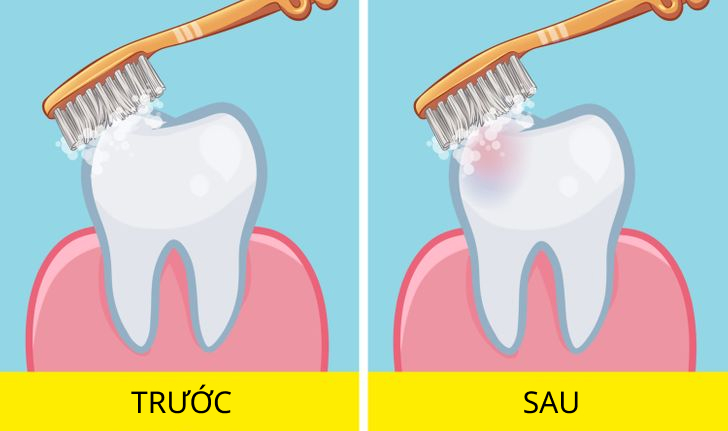 Nên đánh răng trước hay sau ăn sáng? Câu hỏi &#34;muôn thuở&#34; được chuyên gia giải đáp - 3