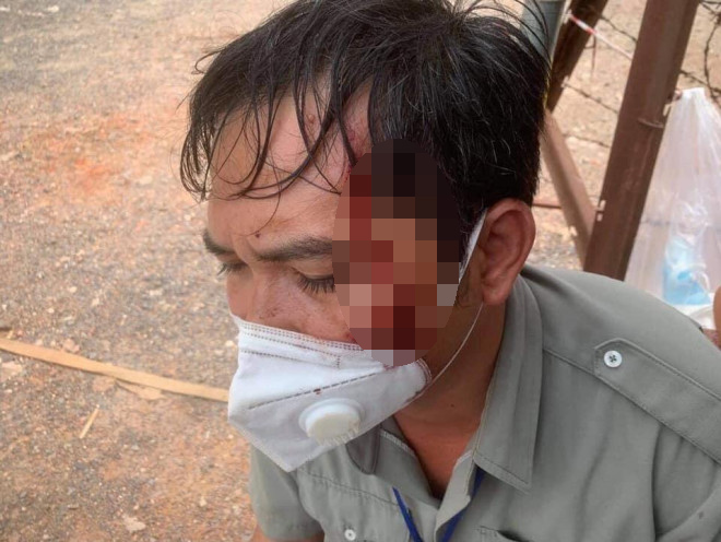 Bảo vệ dân phố Nguyễn Đình Nam bị ném đá trúng đầu chảy máu