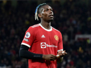 Bóng đá - MU sốc vì Pogba chấn thương nặng: Nghỉ hết năm 2021, bao giờ trở lại?