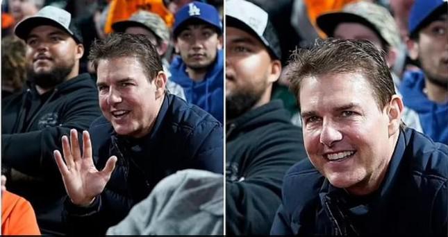 Tom Cruise từng khiến thế giới "sốc" vì gương mặt khác lạ, sưng phù.