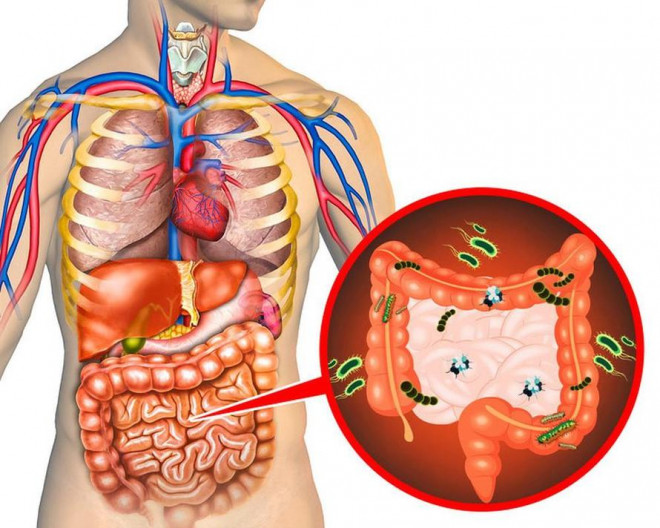 Những dấu hiệu nội tạng đang chứa lượng &#34;rác&#34; quá lớn, cần thanh lọc độc tố ngay - 1