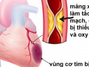 Sức khỏe đời sống - 7 yếu tố nguy cơ gây bệnh tim mạch có thể phòng tránh được