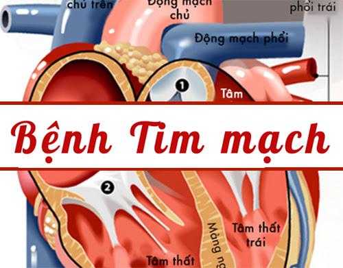 Bệnh tim mạch là bệnh của trái tim và của mạch máu