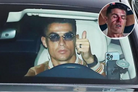 Ronaldo đeo kính “cực ngầu” che mắt sưng, chờ được ra sân derby Manchester