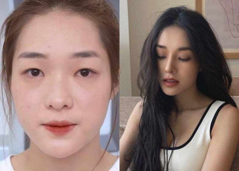 2 người đẹp Nam Định, Thái Bình một bước hóa mỹ nhân nhờ có thể khéo léo dao kéo - 6