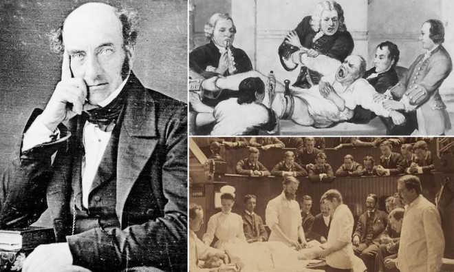 Robert Liston thực hiện cắt cụt chi bệnh nhân trước đám đông khán giả.