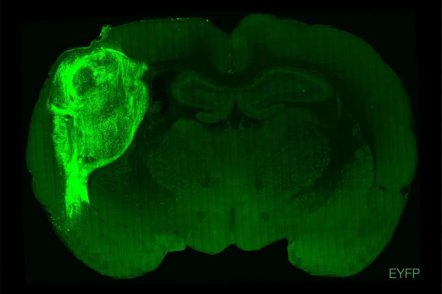 Khối tế bào não người (phần có màu xanh sáng hơn) bên trong não của một con chuột (ảnh: Straits Times)