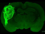 Thế giới - Cấy tế bào não người vào não chuột, chuyện gì xảy ra?