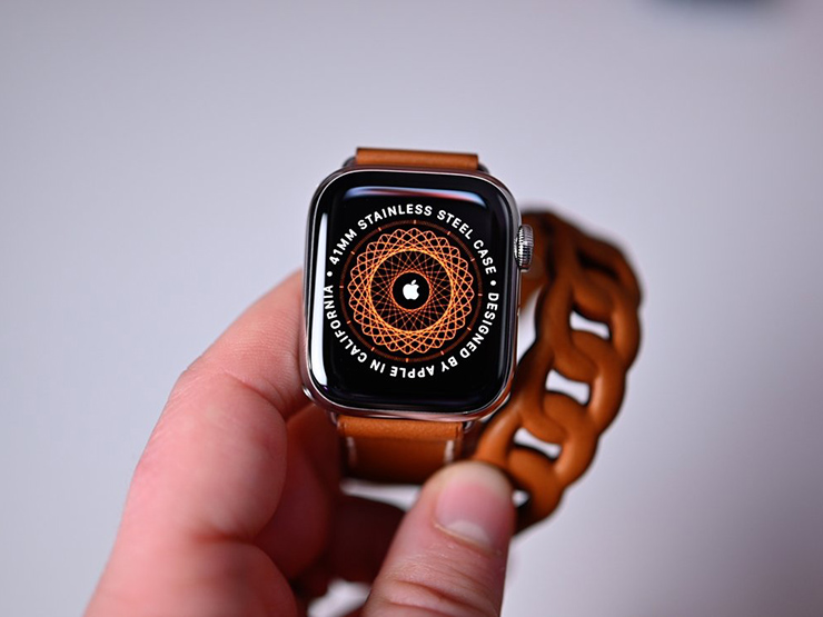 Apple muốn giấu giếm vụ Apple Watch phát nổ khiến chủ nhân đi cấp cứu