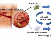 Sức khỏe đời sống - Tìm ra phương thức mới để ngăn ngừa ung thư gan