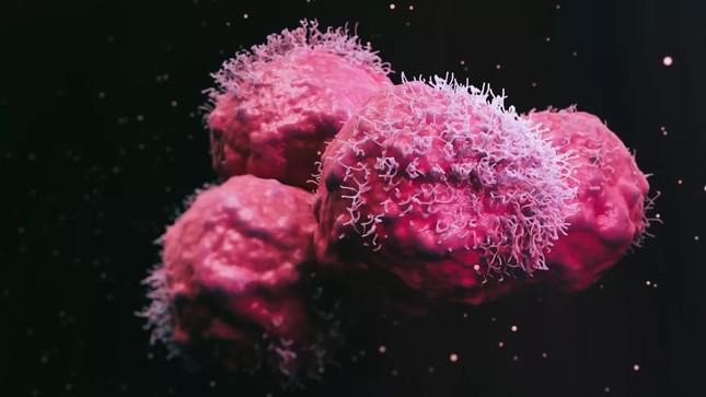 Người phụ nữ được chẩn đoán mắc 12 khối u có đột biến gien chưa từng thấy ở người - hình ảnh 1