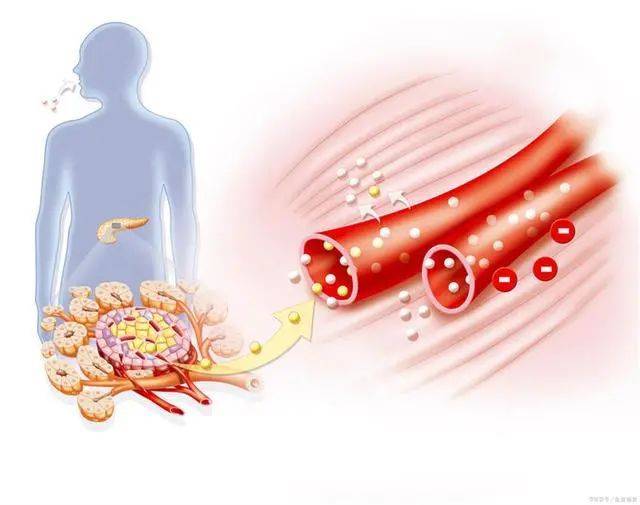 Cô giáo 35 tuổi chết vì tiểu đường dù không ăn đồ ngọt, bác sĩ nhắc nhở không nên ăn nhiều 2 món này - 2