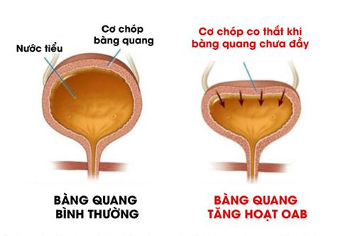 Bệnh lạ &#34;sợ phải uống nước, không dám đi xa&#34; khiến cụ ông giảm còn 35 kg - 2