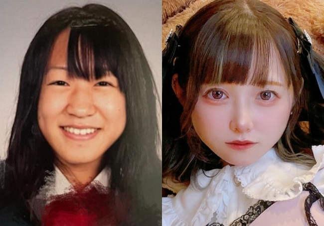 Tiết lộ đụng dao kéo từ năm lớp 5, cô gái Nhật Bản gây tranh cãi - hình ảnh 1
