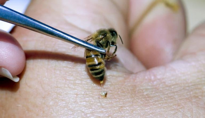 Thực hư thông tin nọc ong chữa ung thư - hình ảnh 1