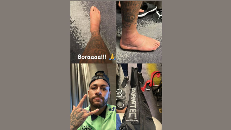 Neymar khoe trên trang Instagram cá nhân bức ảnh về việc mắt cá chân phải của mình đã hết sưng to