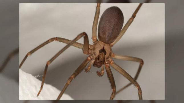Bệnh lạ: Hai người bị phá hủy hệ miễn dịch sau khi bị nhện nâu cắn - 1