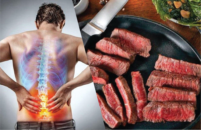 Các loại thịt đỏ gia tăng tình trạng viêm ở sụn khớp&nbsp;