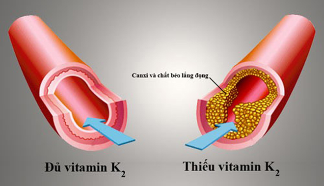 “Giải mã” vitamin K2 và “bí mật” để trẻ phát triển chiều cao tối ưu - 3