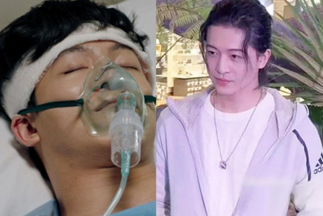 Không thể nhận ra Harry Lu sau tai nạn hỏng hết mặt, phẫu thuật 20 lần