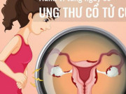 Sức khỏe đời sống - [Infographic] - Những hành vi làm tăng nguy cơ ung thư cổ tử cung