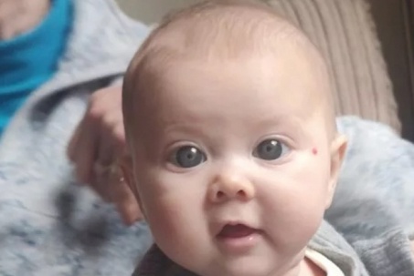 Em bé có đôi mắt xanh đẹp hút hồn - nhưng đó là một triệu chứng nghiêm trọng