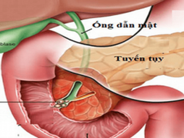 5 loại thực phẩm ”giết chết” tuyến tụy