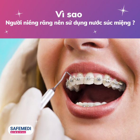 Vì sao người niềng răng nên sử dụng nước súc miệng - 1