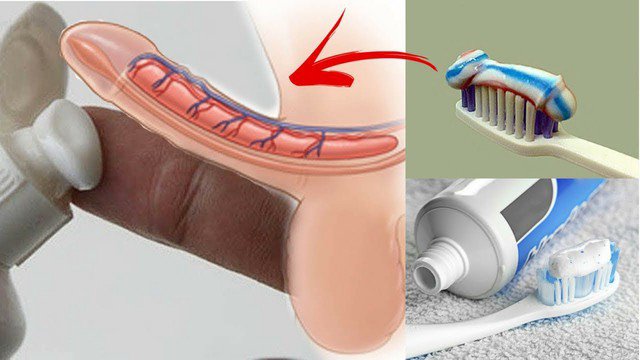 Bôi kem đánh răng chống xuất tinh sớm có hiệu quả không? - Ảnh 3.