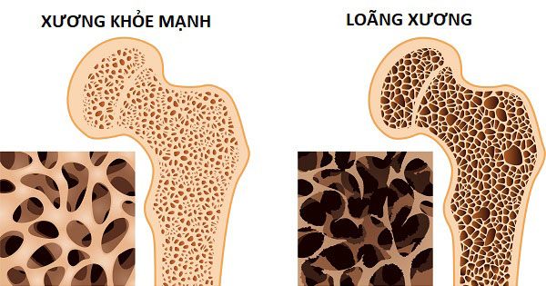 4 loại rau củ giàu canxi hơn sữa, nếu không muốn sớm bị loãng xương, hãy ăn thường xuyên - 1