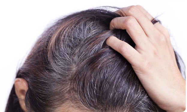Còn trẻ mà bị tóc bạc sớm cùng với dấu hiệu này thì cần khám ngay còn kịp, đây là cách tốt nhất để ngăn chặn tóc bạc sớm! - 2