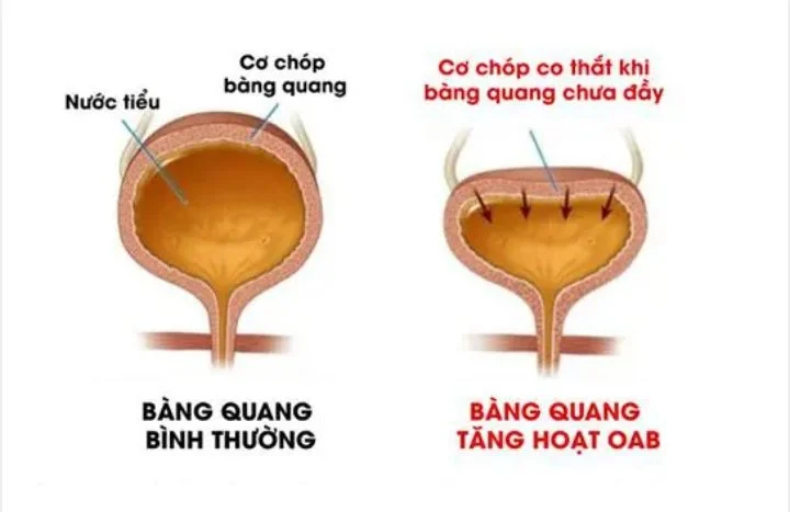 Quy tắc 4T đơn giản nhưng cực hiệu quả giúp giảm tiểu đêm, tiểu không tự chủ - 3