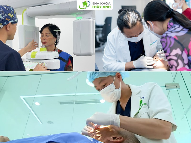 Nha khoa Thùy Anh - Trung tâm trồng răng implant uy tín tại Hà Nội - 1