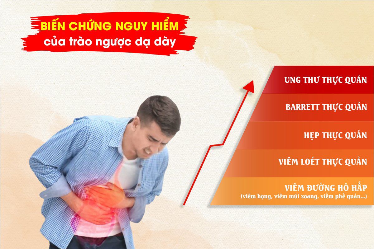 Cổ họng vướng mắc, nuốt nghẹn - Coi chừng trào ngược dẫn lối mở cửa ung thư lúc nào không hay - 3