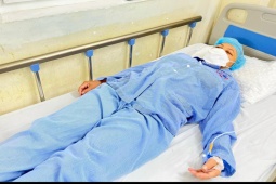 Đau đầu, giảm trí nhớ nghĩ do “ma bắt”, người phụ nữ đi khám phát hiện có u não