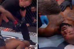 Chấn động UFC: Võ sỹ nhận 19 cú đấm chí mạng, trọng tài mới cho dừng