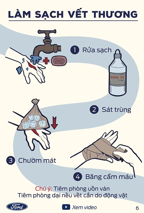 Kỹ năng sơ cứu cơ bản mà các bác tài xế cần nên biết - 4