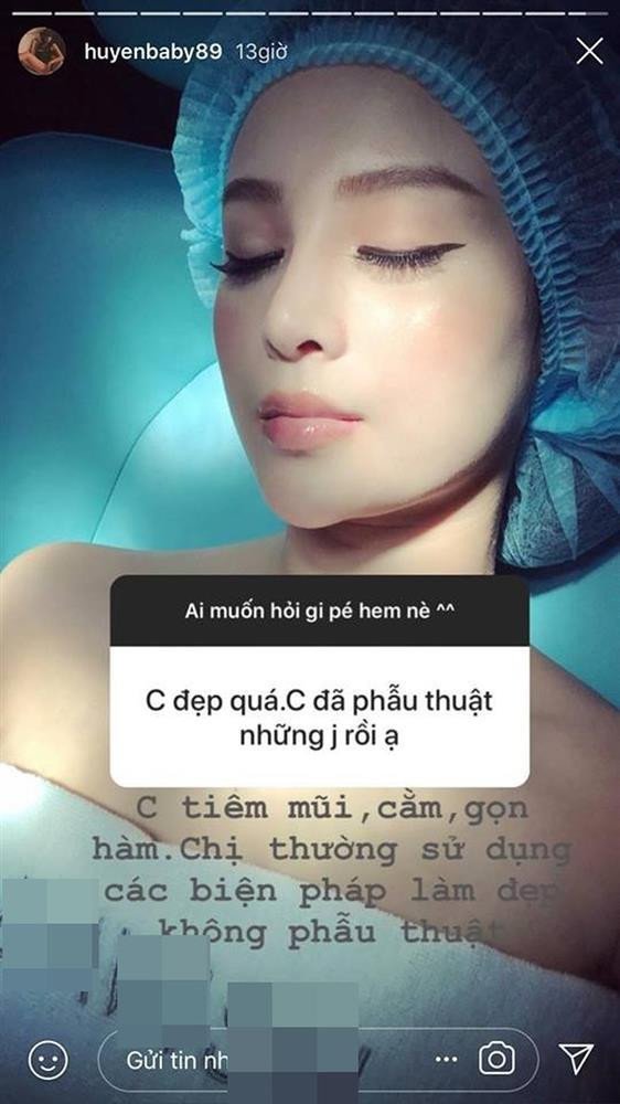 Vợ sắp cưới của Quang Hải công khai chỉnh sửa một điểm trên mặt nhằm có nét đẹp 