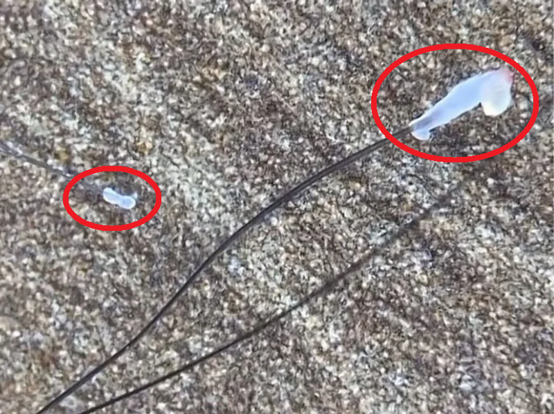 Tóc rụng nhiều, thưa mỏng kèm chân tóc trắng thì là bệnh gì? Giải pháp để kích thích tóc mọc nhanh, chắc khoẻ - 2