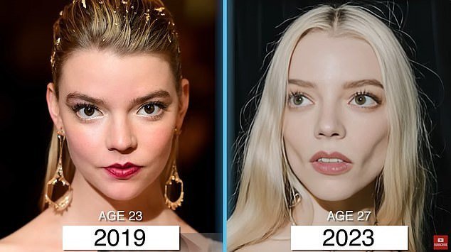 Anya Taylor-Joy trông hốc hác hơn xưa, nhưng cũng có thể do giảm cân.