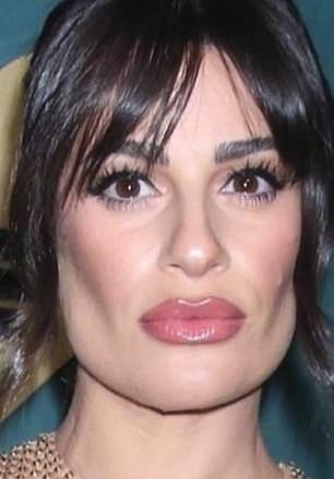 Lea Michele có dấu hiệu má hóp đặc trưng của việc trải qua thủ thuật loại bỏ mỡ má.