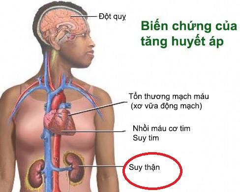 Thanh niên 21 tuổi suýt mất mạng vì suy thận và cao huyết áp, thừa nhận những sai lầm nhiều người Việt mắc phải - 2