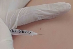 Trẻ 8 tuổi ở Đồng Nai tử vong do sởi, mẹ không tiêm vaccine vì 'bé không bị bệnh'