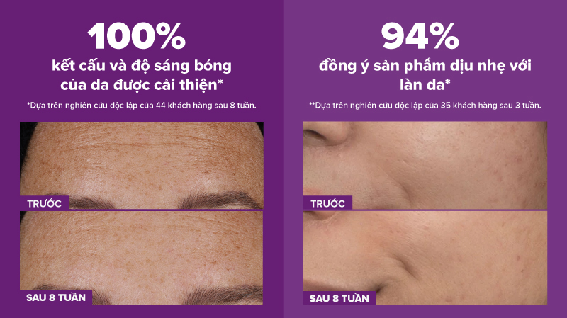 Hiệu quả của PRO Retinaldehyde Treatment đã được kiểm chứng